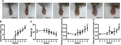 Natural Killer Cells Infiltration in the Joints Exacerbates Collagen-Induced Arthritis